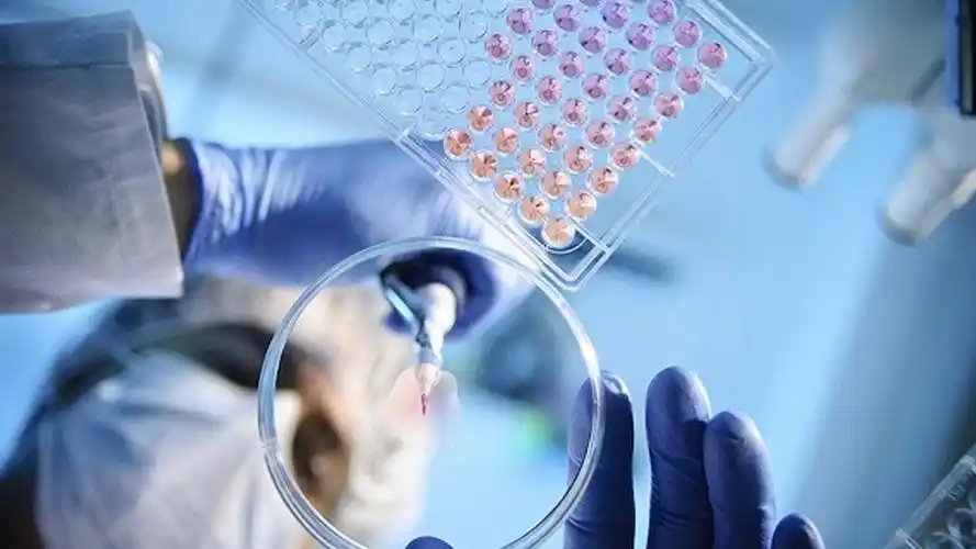 How to ensure the success rate of stem cell transplantation